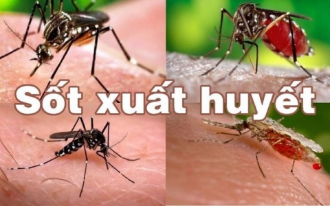 Những việc NÊN và KHÔNG NÊN làm khi trẻ mắc sốt xuất huyết